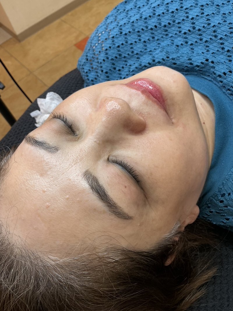 50代女性 アイライン・リップ1回目の施術前後の写真